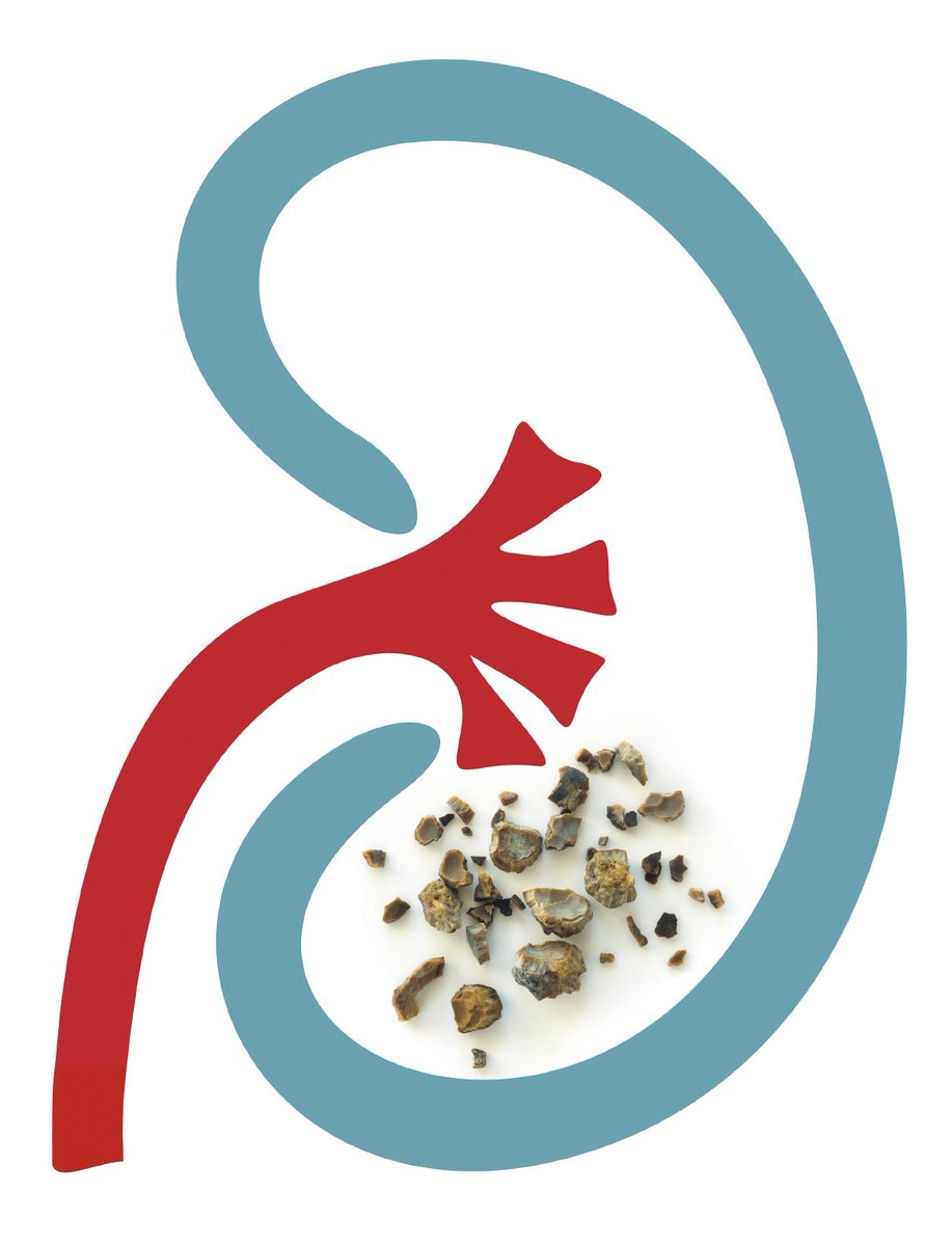 Study says kidney stones are on the rise: hvrd.me/4nmOLY #HarvardHealth
