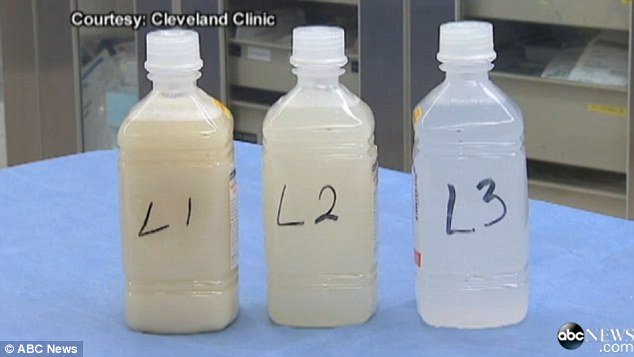 AharonMichael's tweet photo. The fluid flushed through Epperson's lungs went from cloudy to clear as his air sacs were cleaned out #TrollingBio https://t.co/WGfYYIBPCj