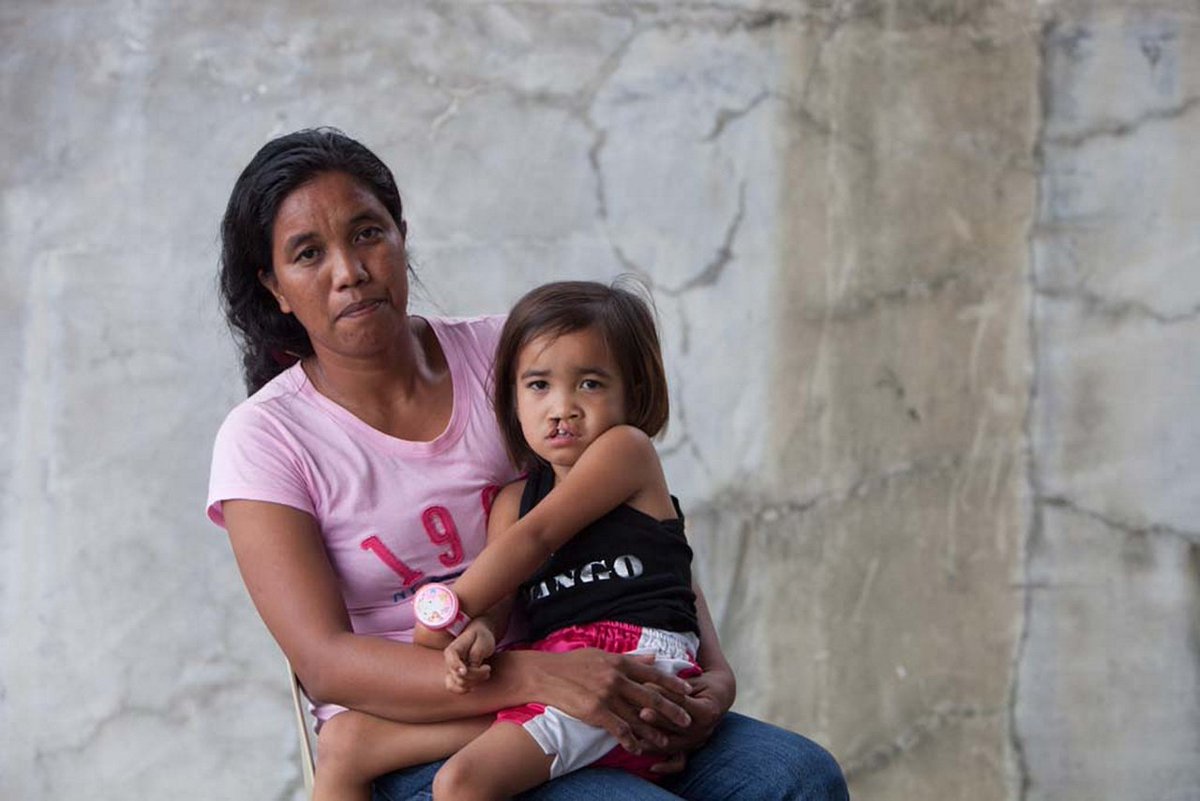 operationsmile's tweet image. Pt. 1) When Lani saw her daughter Hachelyn after she was born, she cried. “I was shocked when I first saw her.”