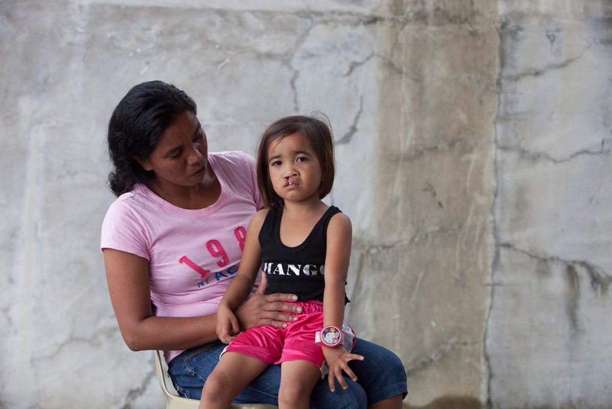 operationsmile's tweet image. Pt. 2) People asked, "What have you done to have a baby that looks like this?” &amp;amp; told Lani to “throw away” her baby.