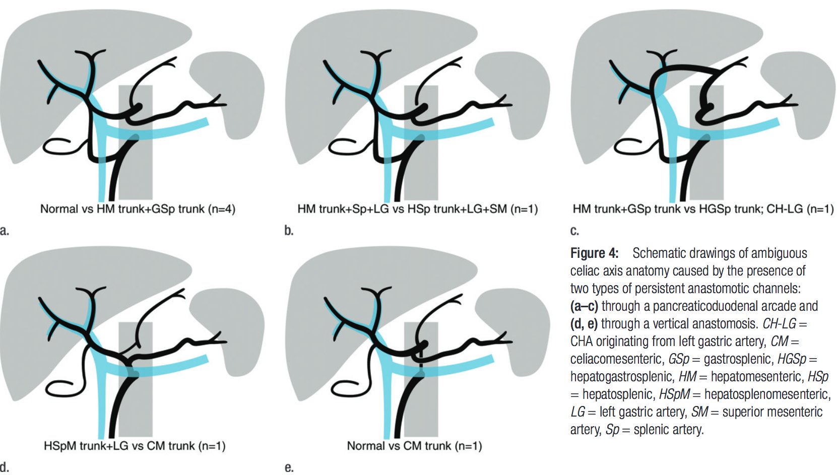 Sir Rfs Paullewismd Uicvir Radres Medstudent Are We Looking At A Hepatosplenomesenteric Trunk Anatomy Meded Rsna T Co Fjszdorlaw Twitter