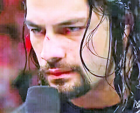 LeeshaNDessy's tweet photo. #Roman #InjuriesOrNot #YouArePerfectForUs #Empires #SeesU #thruEyesofLuv @WWERomanReigns @romanreigns568 https://t.co/F6GzwzdfbG