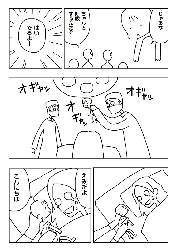 【漫画】帝王切開・新生児誕生
 