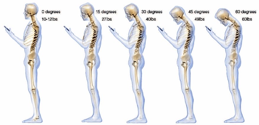 PereaClinic's tweet image. Constantly looking down at your phone can cause a 27 kg force on your neck
releaseremedials.com.au/?p=153
#posturealignment