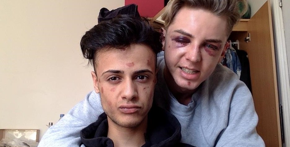 AttitudeMag's tweet photo. Brighton couple viciously assaulted in alleged gay hate crime: https://t.co/EamiNI81B3 https://t.co/OOBcBcTH5l