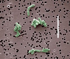 magibarneda's tweet photo. Els formatges d'olor de peus són els de pell fregada! El #craba de Taüll (Brevibacterium linens) n'és un exemple! https://t.co/UtVXRj8V2A