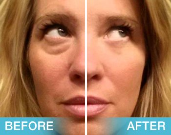 !!! 2 Minute Facelift !!!

See Live Demo &amp; Shop here -
buff.ly/1NV2Sub

#TotallyAgeless