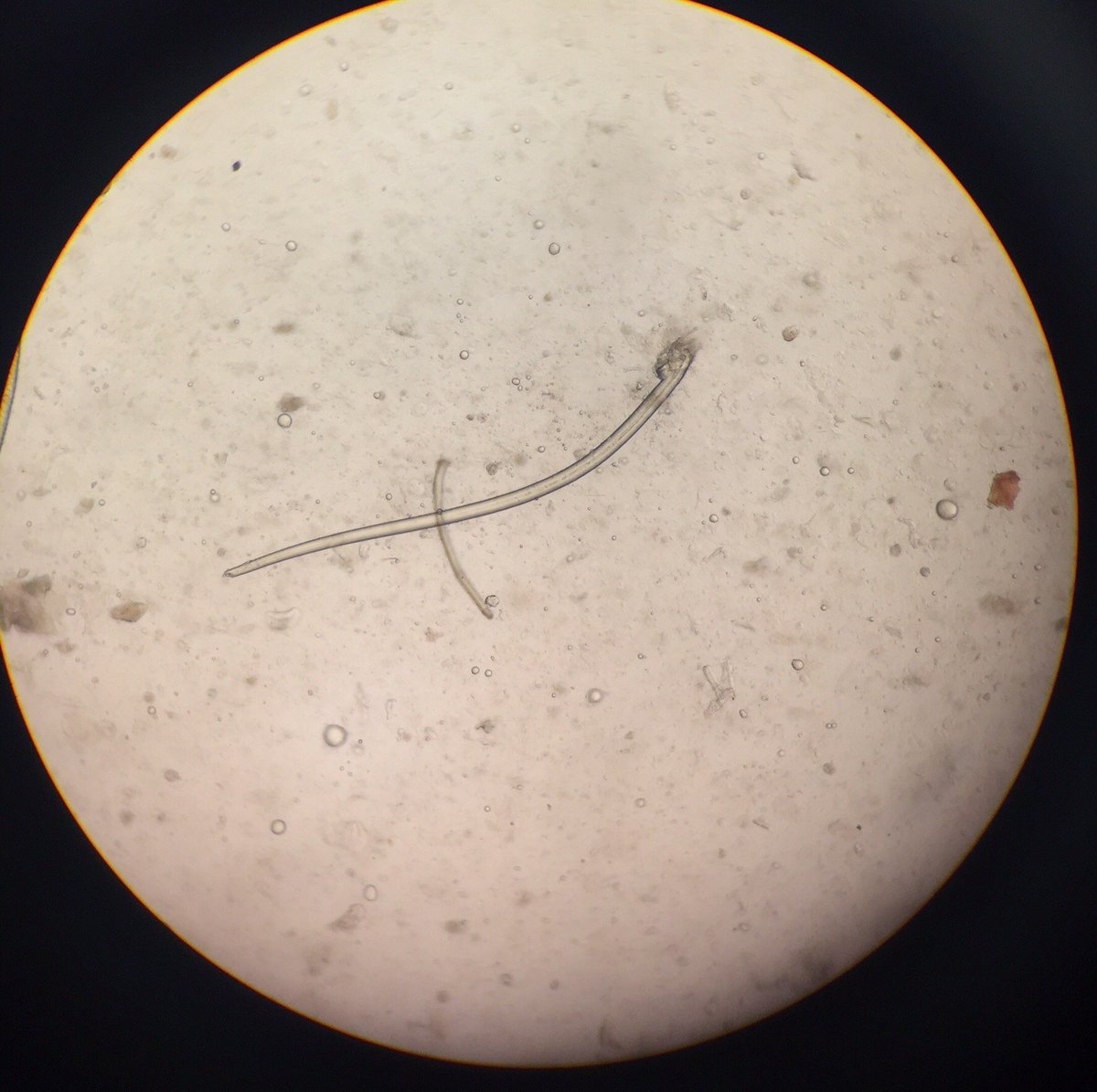 Ashcroft_Vets's tweet photo. If anybody is interested here are the pictures of the lung worm we diagnosed last week :-) https://t.co/Y4UF1kD3N2
