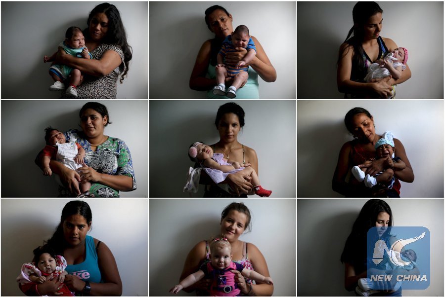 XHNews's tweet photo. Almost one-sixth of #Brazil's confirmed #microcephaly cases linked to #Zika https://t.co/qRYETTTBWv https://t.co/Wap0pG2oRq