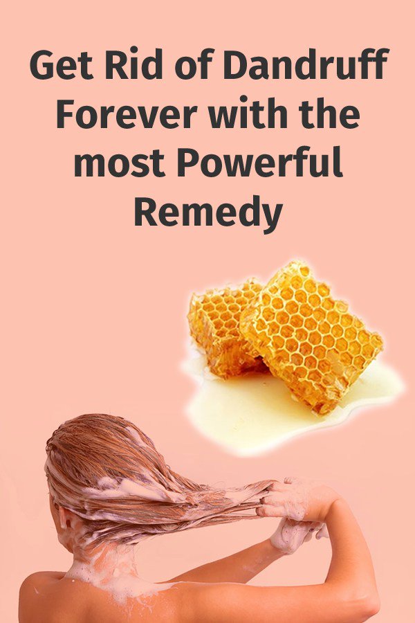 DIYandCraftTuts's tweet photo. Get Rid of Dandruff Forever with the most Powerful Remedy https://t.co/FZNxyVQUyT https://t.co/hDp5TNqCH8