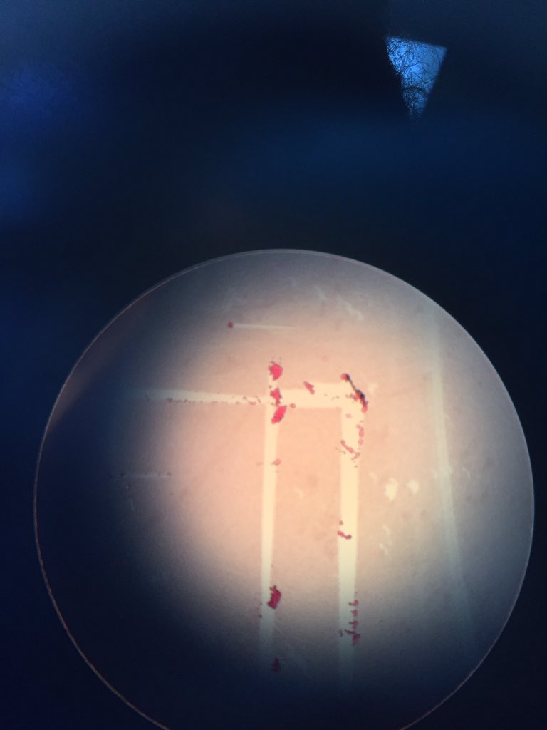 rbailey___'s tweet photo. Gram staining Anna's bacteria! @2thedorkside #RHSBMS https://t.co/g6QxGZuQ4P