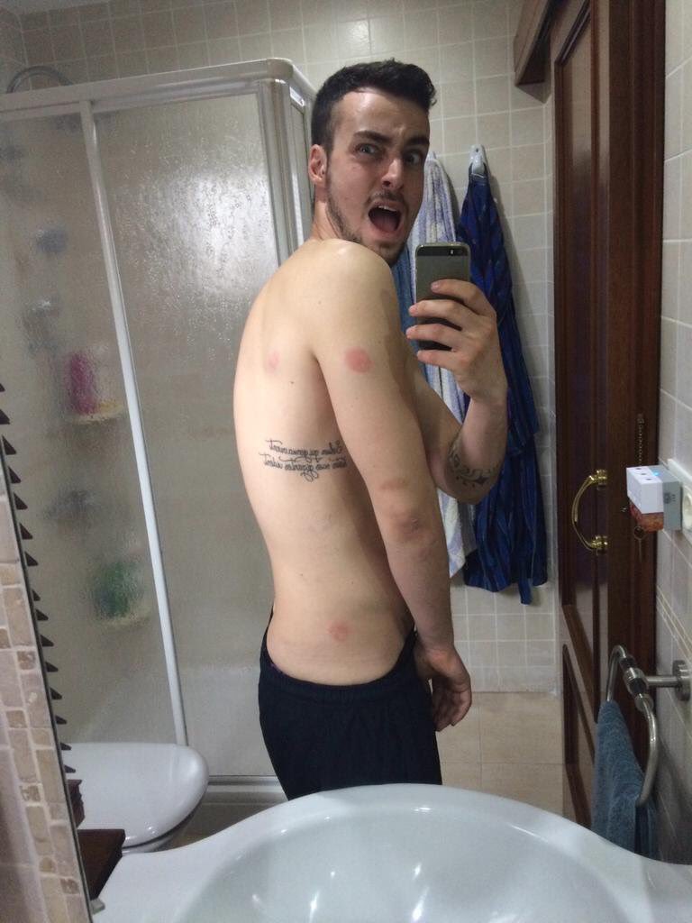 UrbasurF7's tweet photo. @carlosCourtuas desde que bebí sangría bomba se me cae la piel pero a cambio tengo el trócolo como el de Alex Diago https://t.co/AV0JTIy7I3