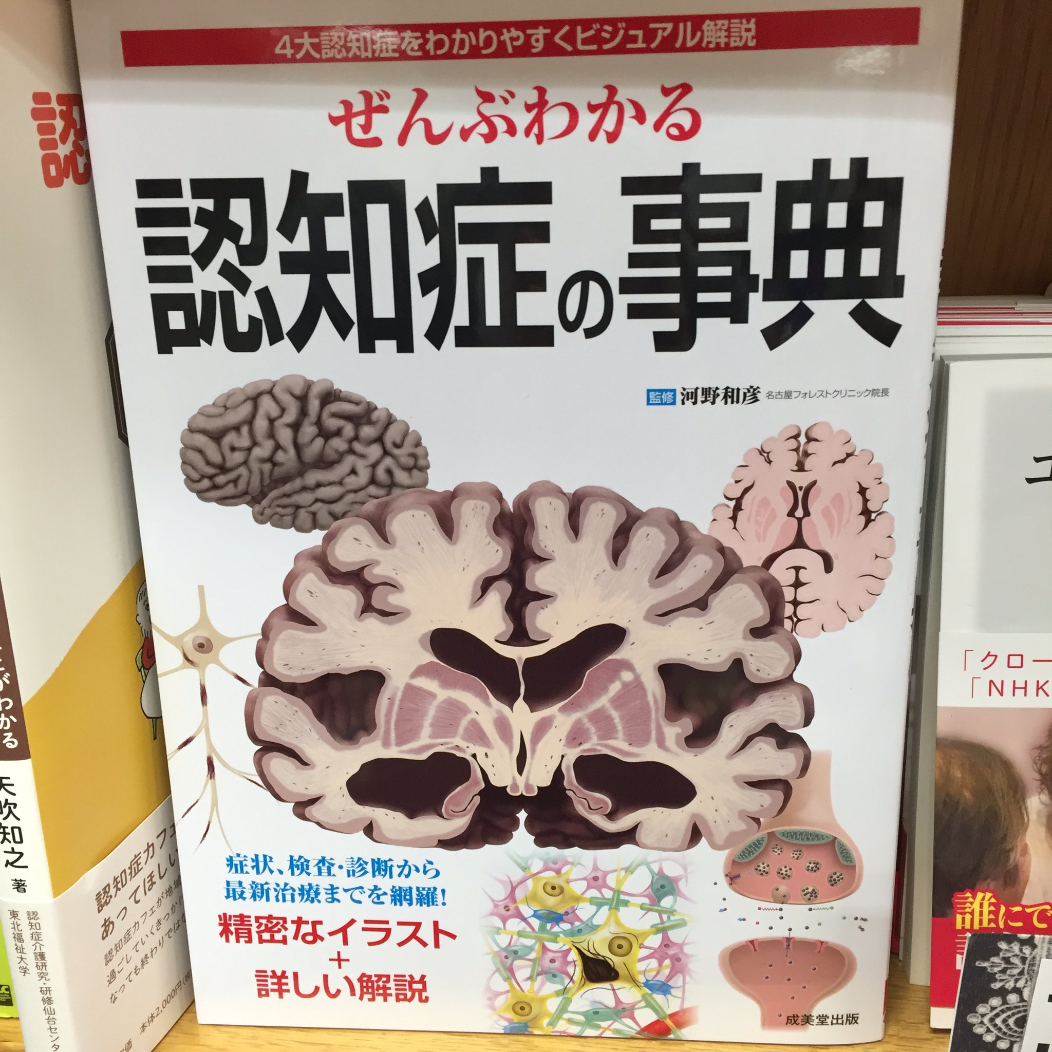 紀伊國屋書店新宿医書センター 介護 いま注目の一冊 ぜんぶわかる 認知症の事典 成美堂出版 脳のイラスト が目を引く表紙 Mri画像を見ながらアルツハイマー型やレビー小体型認知症のメカニズムを追う新型書籍の誕生です Ak T Co