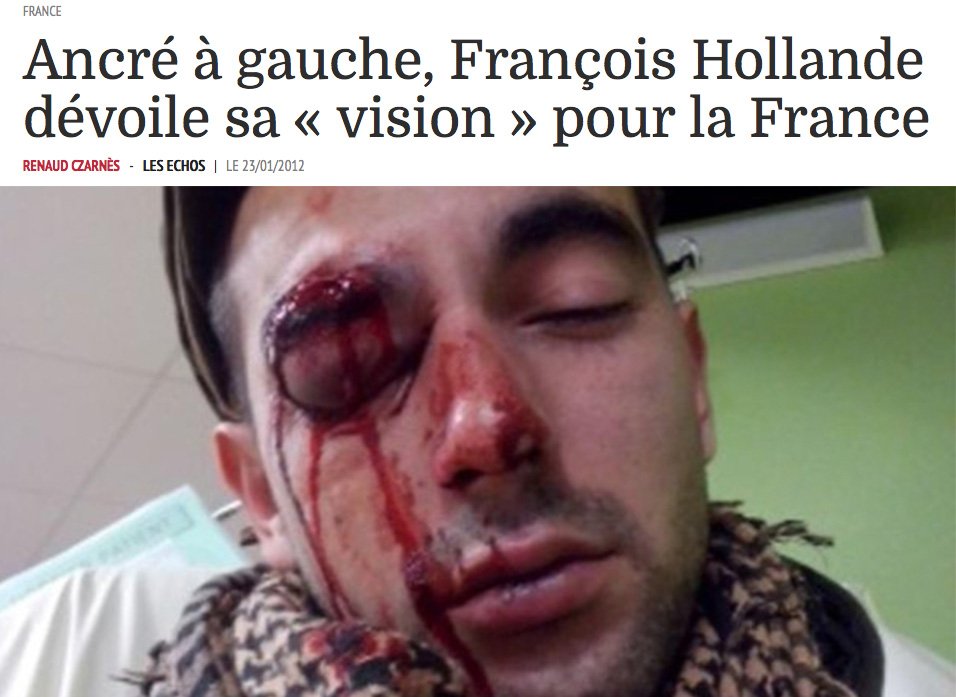 simbison's tweet photo. Le social-libéralisme c'est trop beau pour être vrai heureusement le gouvernement est là pour éborgner les rêveurs https://t.co/5BGVybbIvG
