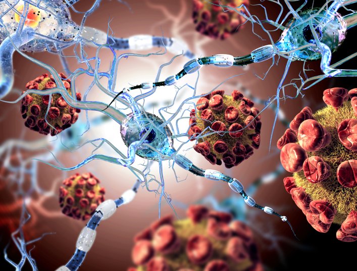 More than two times as many women develop MS. #factsfriday  bit.ly/1KSvuNJ