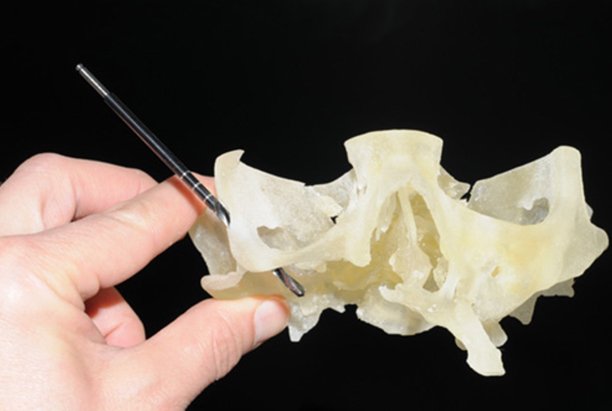 3dPrintedJobs's tweet photo. 3D Printed Jaw reconstruction https://t.co/Qe0woBuz3U    #3dprinting #surgery #reconstruction https://t.co/FtQ6YsCtkA
