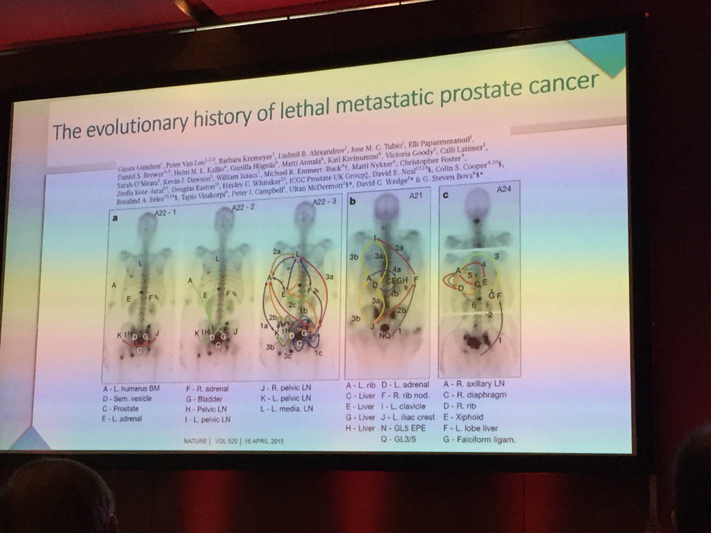Rationnel traitement local dans le cancer de la prostate oligo métastatique