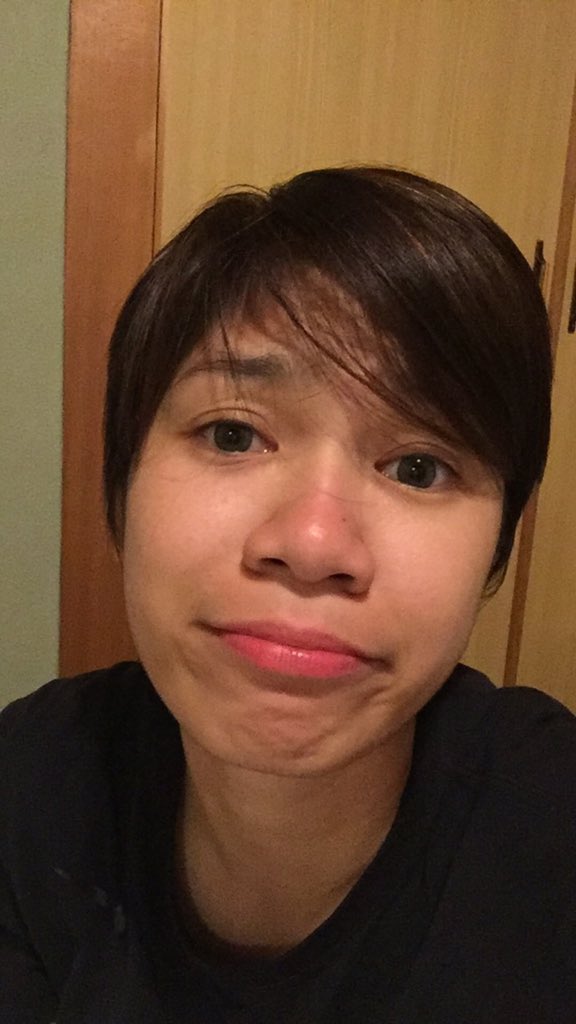 dbuzzketball's tweet photo. @mikareyesss got sunburned this afternoon.... and heres how she looks now. At least sun burned and not heart burned https://t.co/z4wItu56s3