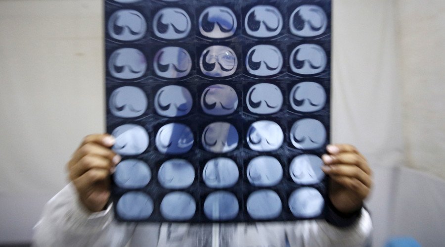 Ricerca Shock: Tumori causati più da un cattivo stile di vita 