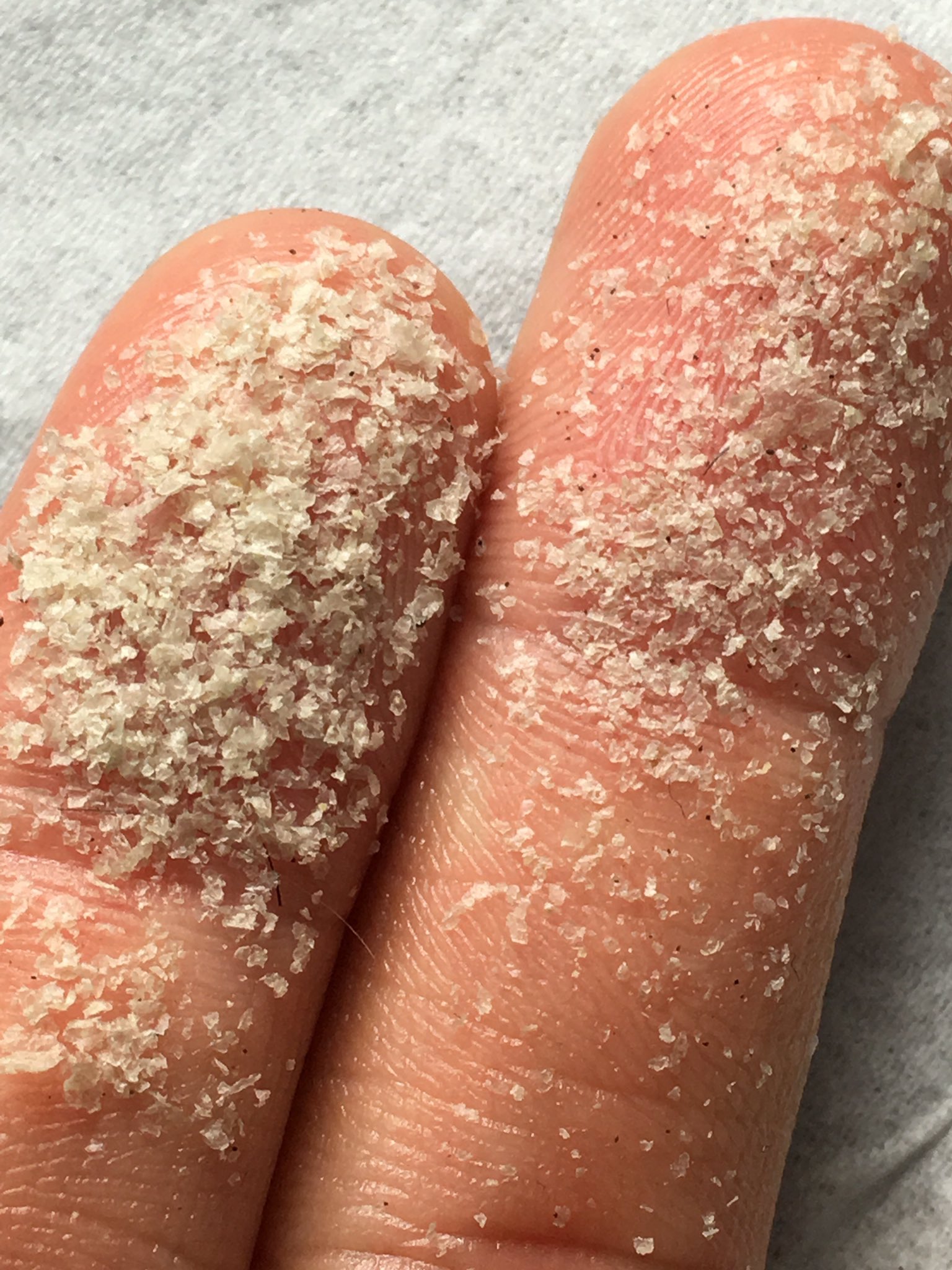 落屑くん アトピー בטוויטר 今日の落屑はすごいぞ 一部皮剥けもあったので乾燥がうまく進んでるのかな