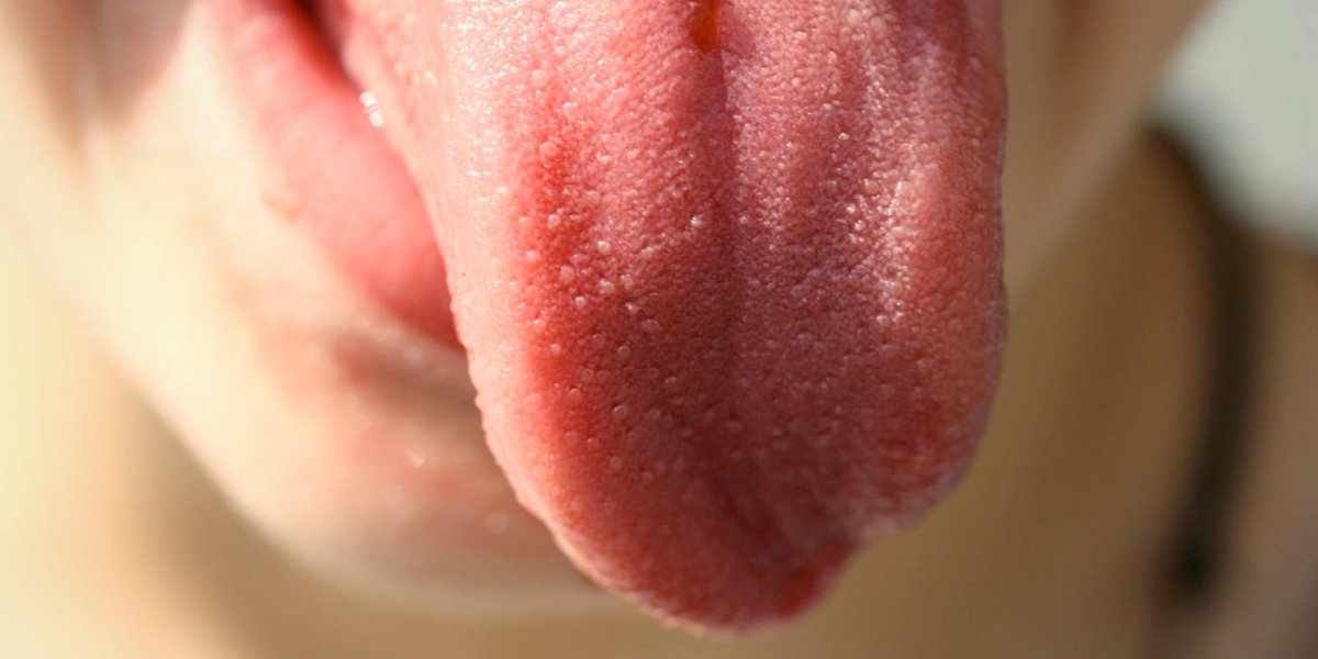 WebMD tweet picture