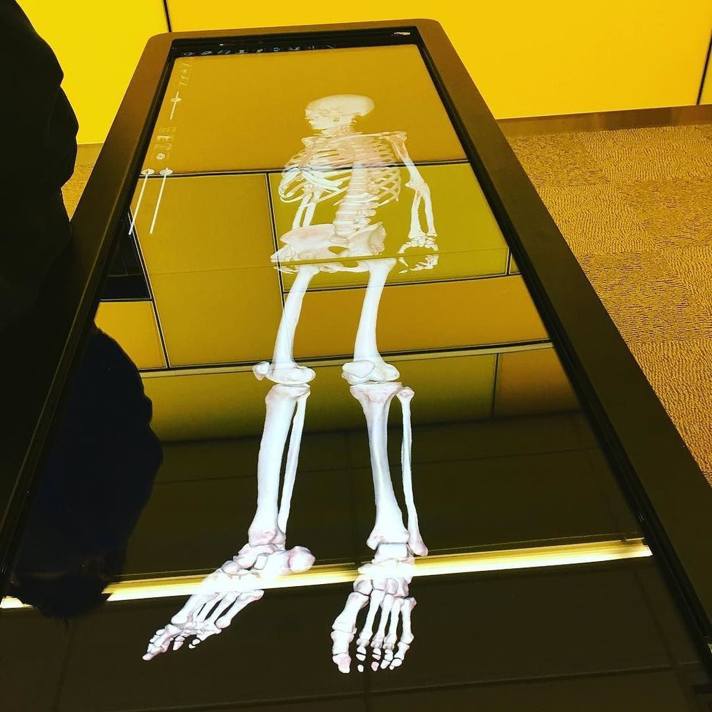 joyclee's tweet image. Visualizing the human body! It was not like this when I was in Med school! #design #datavi… ift.tt/1W6w4RP