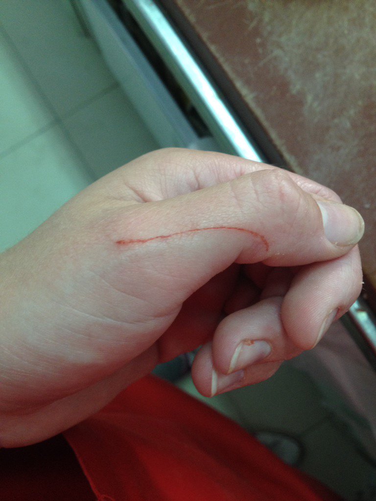 InmaaSL's tweet photo. Duele https://t.co/UZ5cAGVzf9