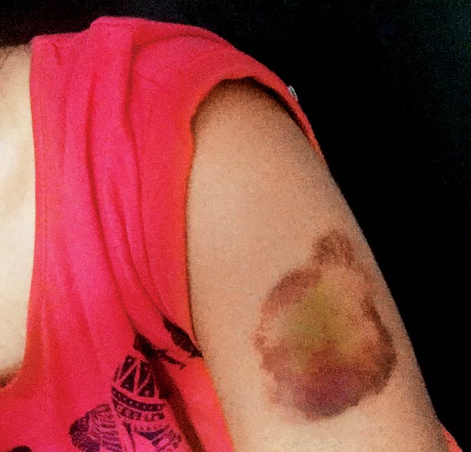 YaarPataHai's tweet image. Pune Woman Dragged out of car and trashed for wearing &quot;short dress&quot;  wp.me/p71Q59-1xT
RT for justice! #News