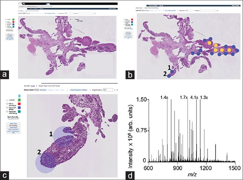 Pathinformatics's tweet image. Pathology interface for the molecular analysis of tissue by mass spectrometry
bit.ly/1rKkY7S