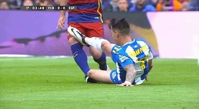 futbolmayuscula's tweet photo. En el minuto 3 de partido no se hace ésta entrada si no es porque lo traes premeditado de casa.
Que vergüenza https://t.co/orMPPNQS75