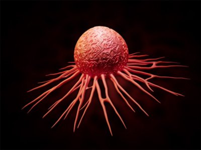 DentistryIQ's tweet photo. Study shows those w/ P. gingivitis have 59% greater risk of developing #pancreatic #cancer https://t.co/iPUwDWRHwH https://t.co/FozIJcMcxr