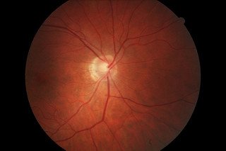 Stay_Young_Tips's tweet photo. Eye Care Advice You Need To Read - https://t.co/HFMBij3ly6 https://t.co/bBrWvZSBX3