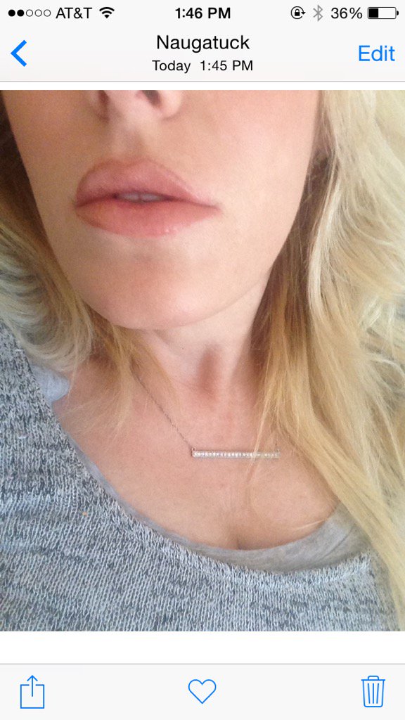 dietcoke78's tweet photo. I like my nostrils, earlobes and elbow skin equally. #mybestfeatures https://t.co/VYEzeDRUuA