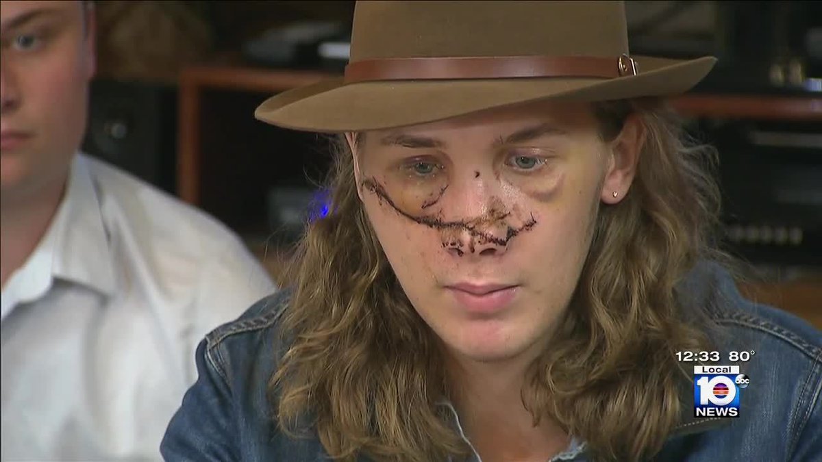 South Florida man seriously injured by flying debris on I-95 bit.ly/1rLXW0B?utm_me… https://t.co/1dTnO1ymdY