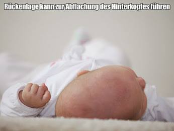 Cranioform Ca Der Kinder Unter 6 Monaten Haben Einen Flachen Schiefen Kopf Baby Helmtherapie T Co 6mw1pnwq0r