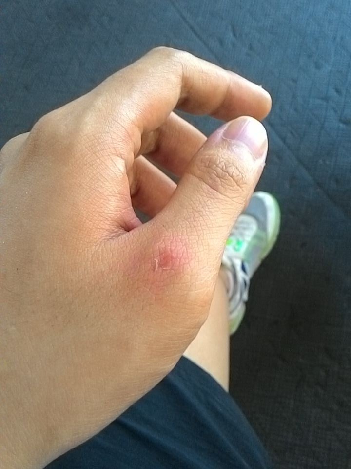Ouch! Gym pa Alonzo! 😕