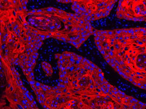 Cancer_Society2's tweet photo. The GE's Global Research scientists formulated a new technology called MultiOmyx. https://t.co/HFDfSGDAau https://t.co/9m5Nphh4ff