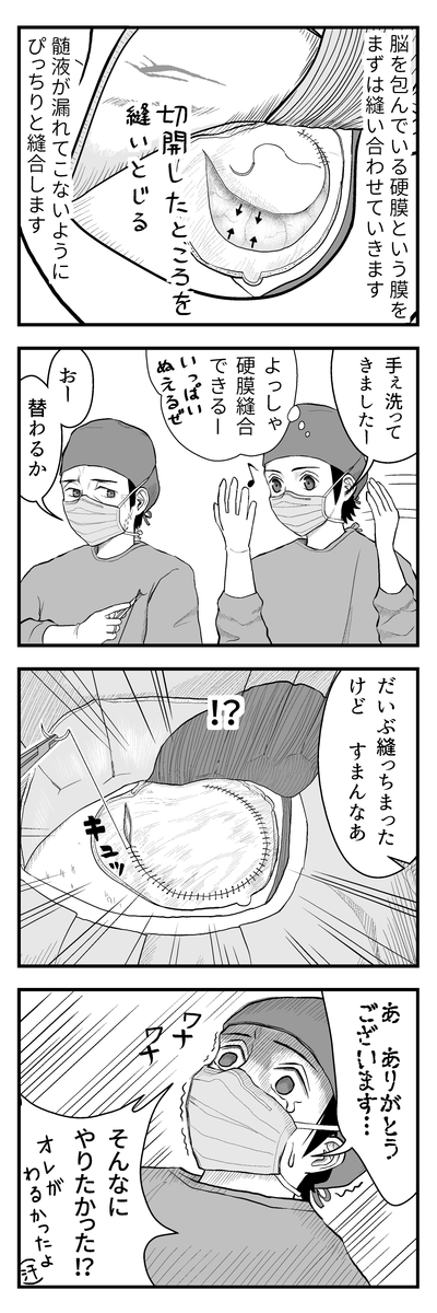 ブログ更新のお知らせ→ のうげかなう。 : 067 はじめての開頭手術19 硬膜縫合 https://t.co/66DAqNEXjZ 