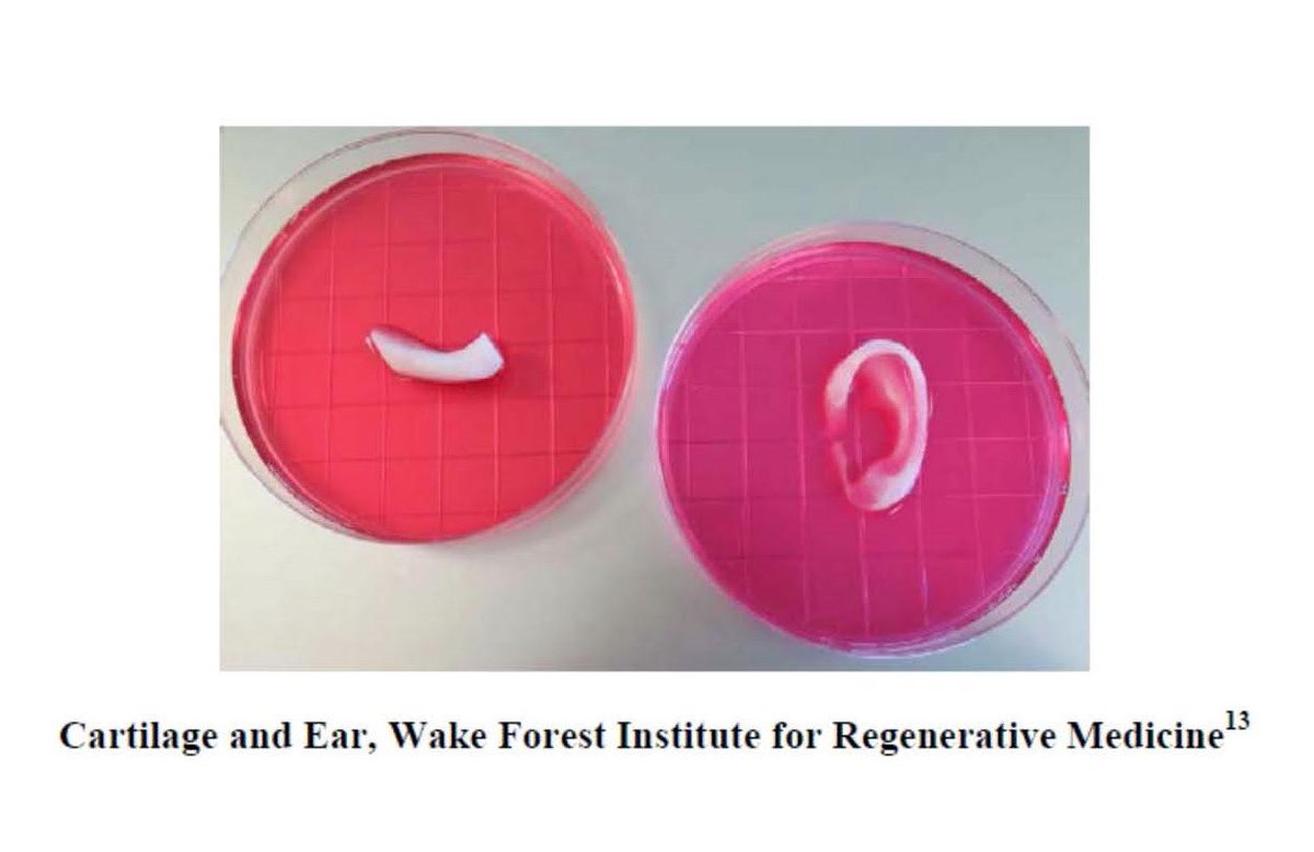 layersappio's tweet photo. 3D Bioprinting of Tissues and Organs:  Where Ar... https://t.co/IYyZtiZpxO #3dprinting | https://t.co/i141CuQEXt https://t.co/y6So31Brwt