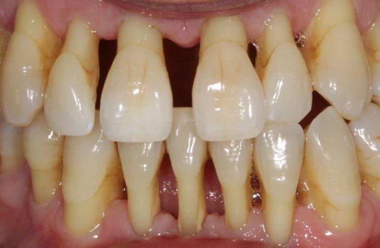 If you want to change something big, change something small everyday. Prevent gum disease by brushing &amp; flossing.