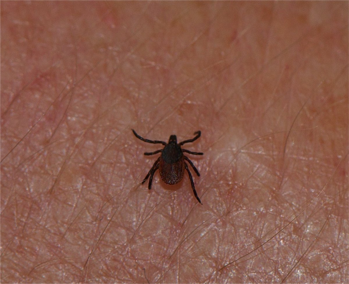 weathernetwork's tweet photo. Ticks that cause Lyme disease found in Toronto. Here's where https://t.co/Zn9A8W9eks https://t.co/0VFfoQR6hr