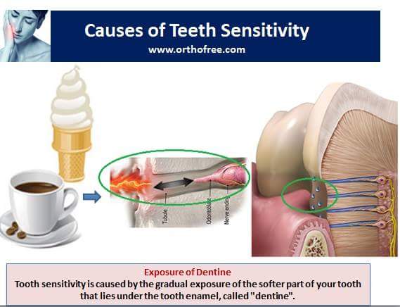 SalamDuta's tweet photo. Knp dentin klo terbuka jd ngilu? Karena di dalam dentin itu ada tubuli dentin, yg meneruskan dingin/panas ke saraf https://t.co/RTCaJquxPi