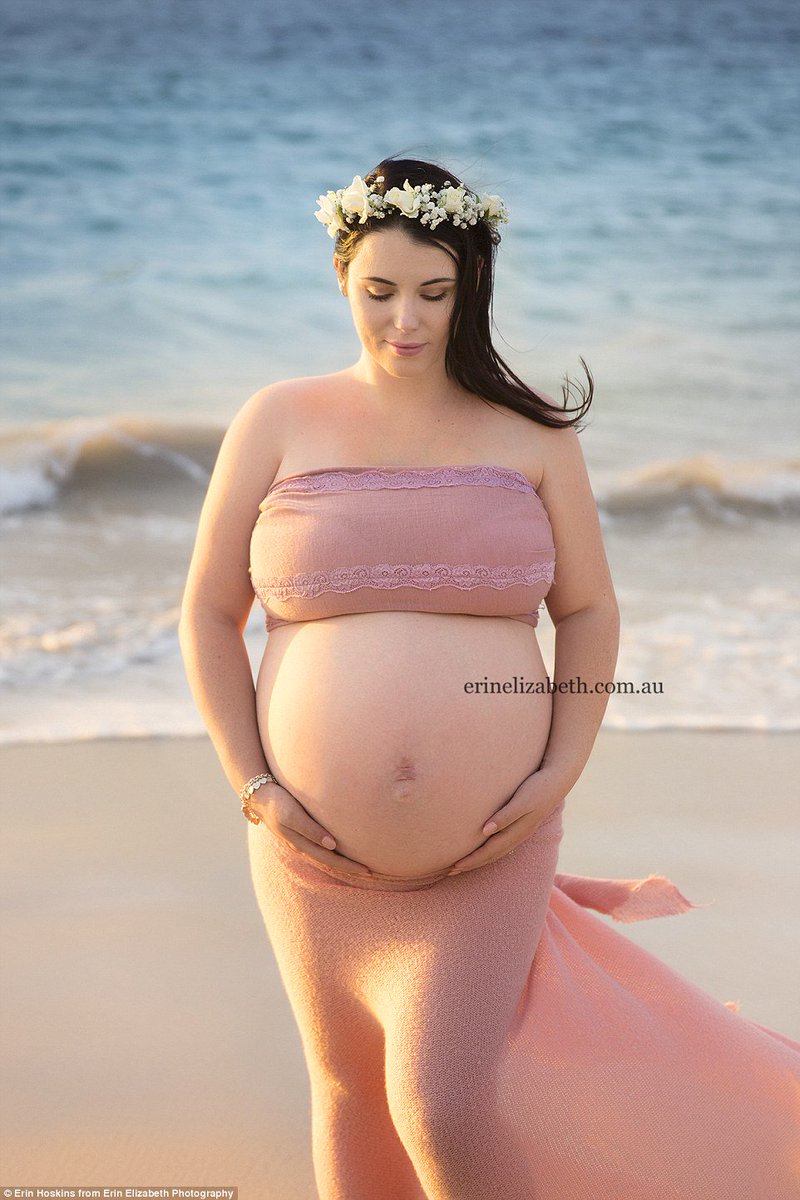 GratitudeDNA's tweet image. คุณแม่ในออสเตรเลียที่ตั้งท้องลูกแฝด5ตามธรรมชาติ (1ใน55ล้าน)และผ่าคลอดออกมาครบ5คนภายใน2นาที ใช้ทีมหมอพยาบาล50คน!