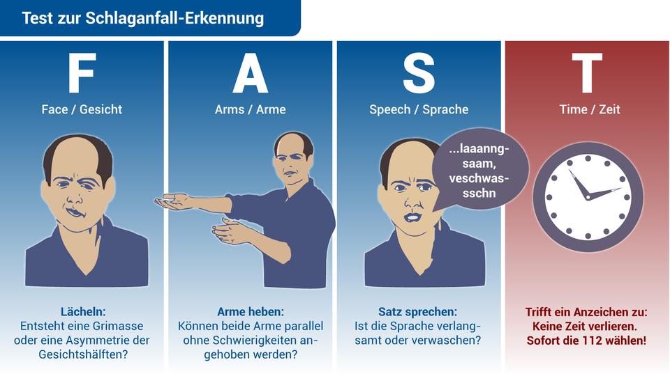 Wie Sie einen #Schlaganfall schnell erkennen, zeigt ihnen folgende Grafik. #Notfall #Zahnarztpraxis #Mittwoch