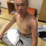 無人島からの脱出に成功した人のその後がこれっ...かなりヤバそうだ!