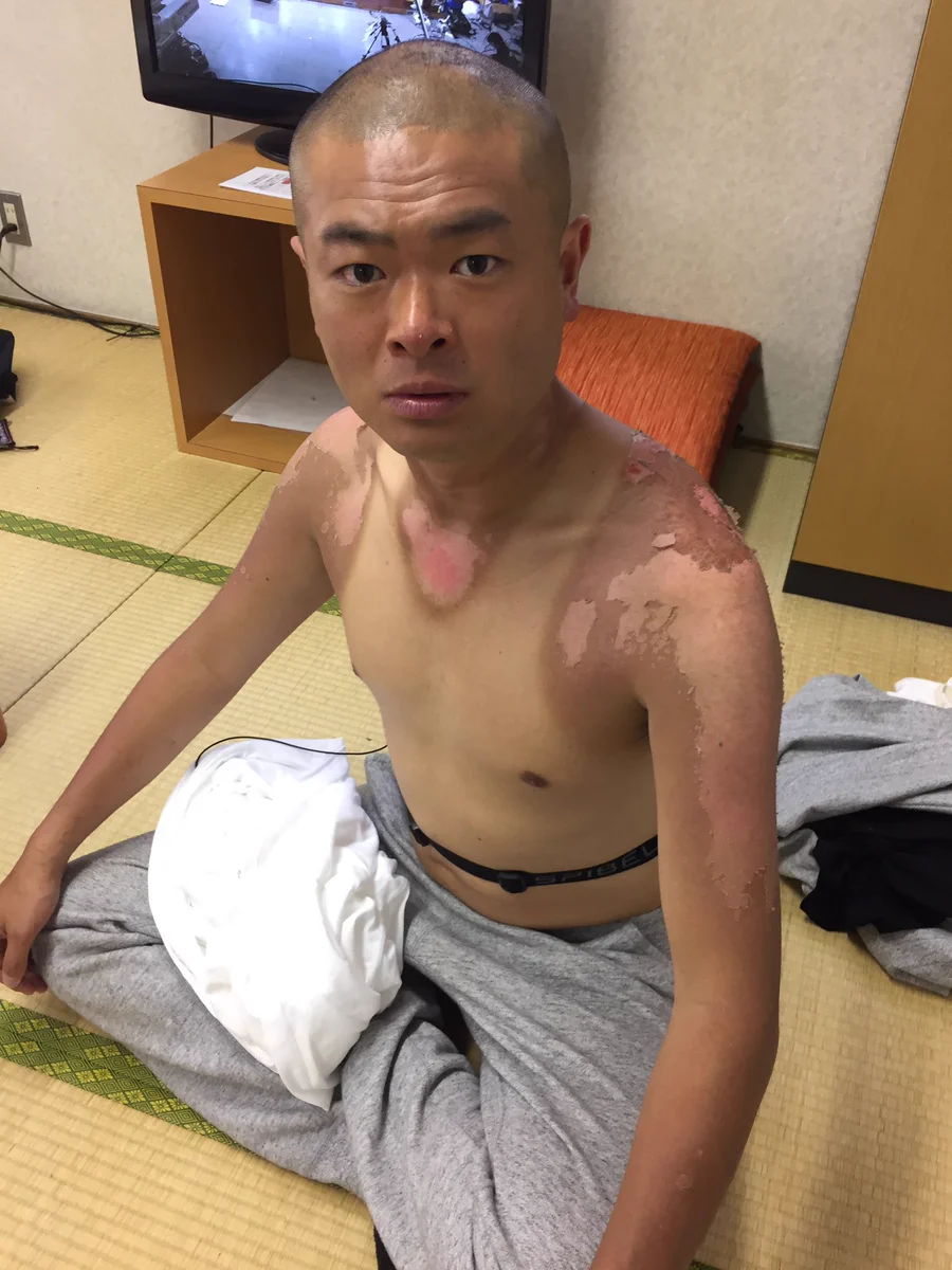 無人島からの脱出に成功した人のその後がこれっ...かなりヤバそうだwww