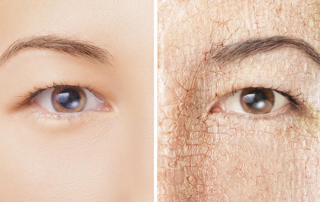 MakeAMudMask's tweet image. Suffering from dry skin? Our homemade moisturizing mud mask recipe can help… howtomakeamudmask.com/2016/01/20/tre…