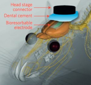 digikey's tweet image. These #BrainImplants Are Designed to Melt and Leave No Trace Behind ow.ly/XFek3005tP7