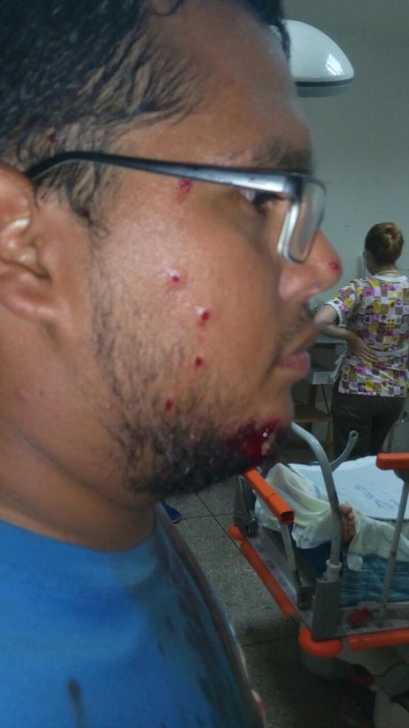 freddysuperlano's tweet photo. El régimen irresponsable y cobarde de #Barinas envía A secuaces a atacar nuestra marcha pacífica. #CNERevocatorioYA https://t.co/GNP2ALyoYC