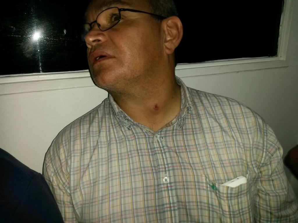 freddysuperlano's tweet photo. El régimen irresponsable y cobarde de #Barinas envía A secuaces a atacar nuestra marcha pacífica. #CNERevocatorioYA https://t.co/GNP2ALyoYC
